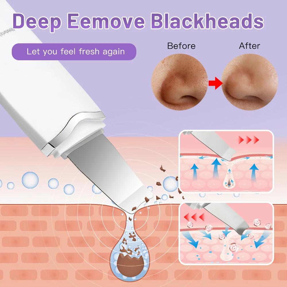 Épurateur de peau électrique à ultrasons, vibration du visage, spatule, épluchage, dissolvant de poi