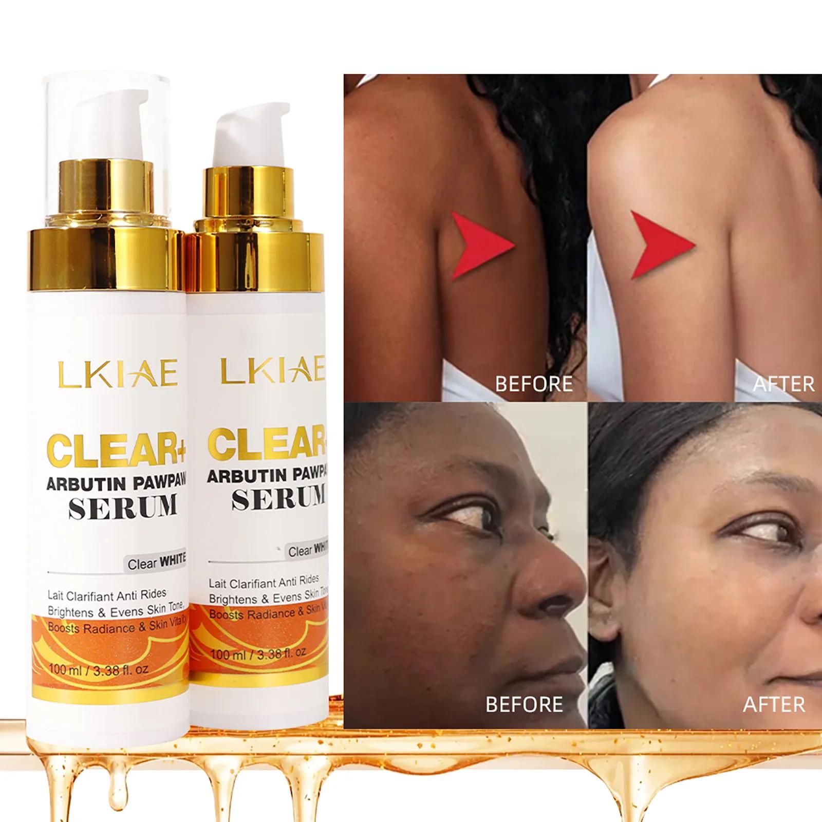 Sérum éclaircissant à l'arbutine LKIAE, hydratant, élimine les taches brunes, les points noirs, la m