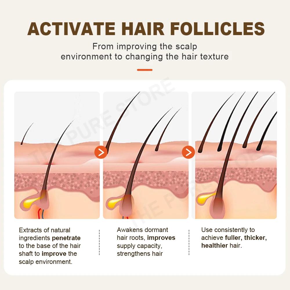 PURC – shampoing au gingembre, traitements contre la perte de cheveux, nourrissant, lissant, épaissi