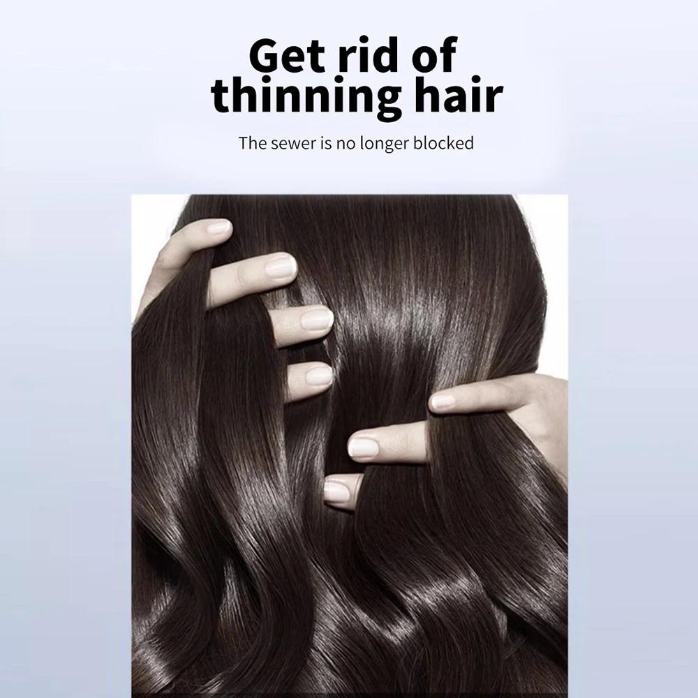 FEG prévenir la perte de cheveux et stimuler la croissance des cheveux Spray de croissance des cheve