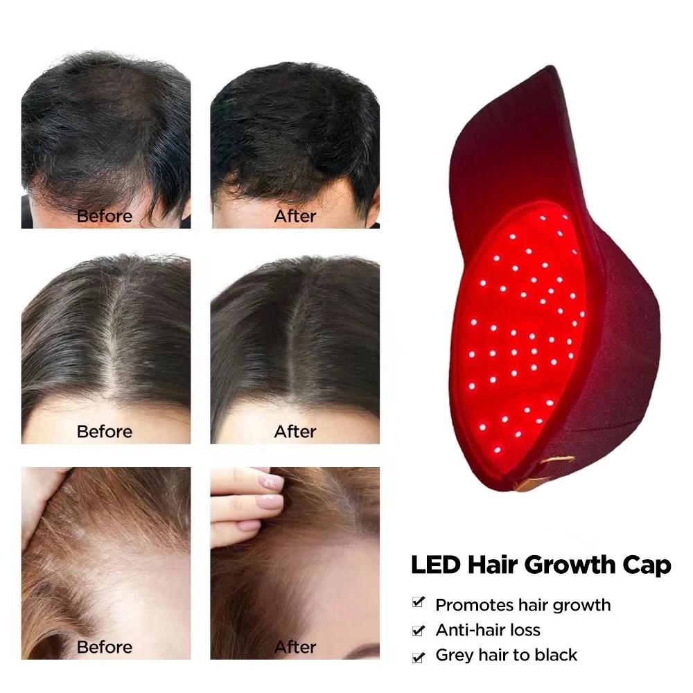 Casquette de thérapie de croissance des cheveux infrarouge à la lumière rouge, chapeau anti-perte de
