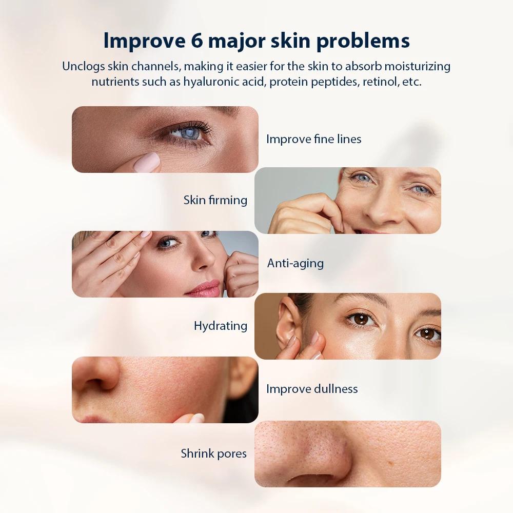 Stylo à bulles d'oxygène CO2 oxygène Machine faciale Portable CO2 Gel dispositif de soins de la peau