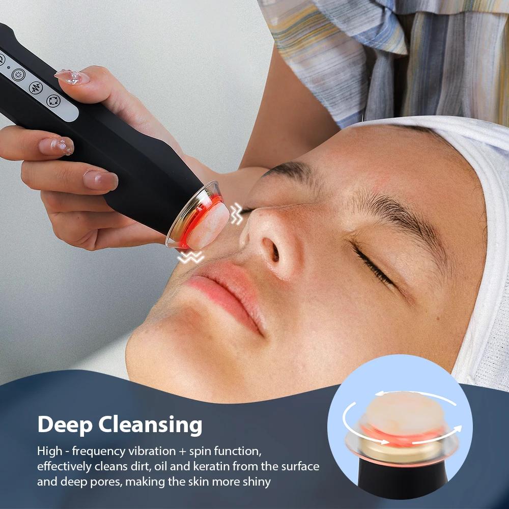 Stylo à bulles d'oxygène CO2 oxygène Machine faciale Portable CO2 Gel dispositif de soins de la peau