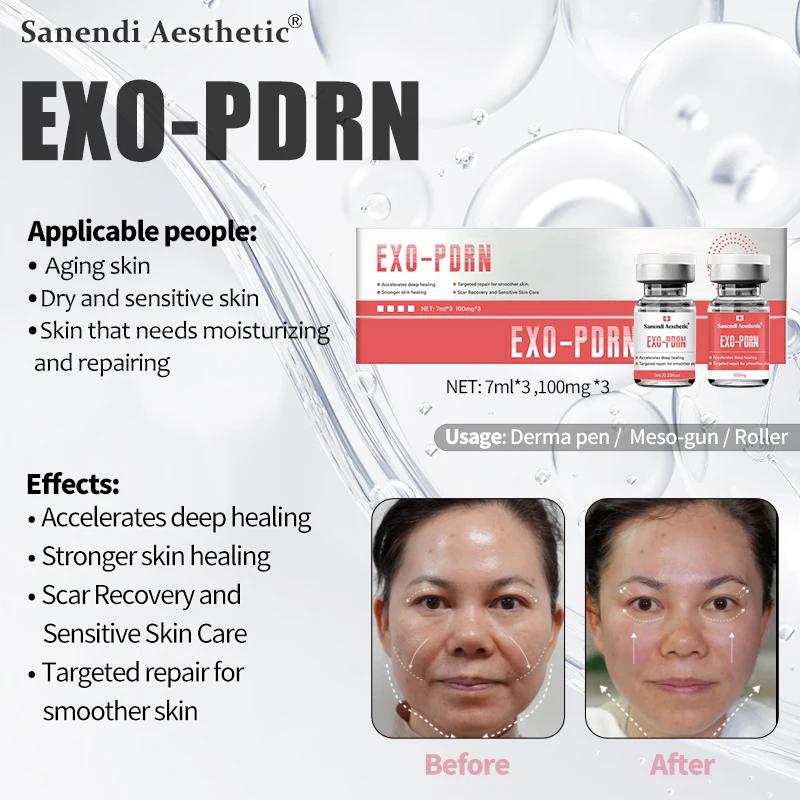Sérum Anti-âge pour exosomes PDRN, élimine les ridules, les cicatrices d'acné, Anti-inflammatoire, s