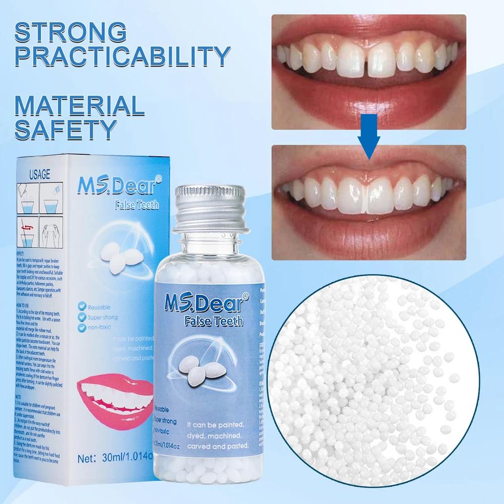 Granulés de réparation temporaire des dents en résine, 30ml, espace dentaire manquant, dents cassées