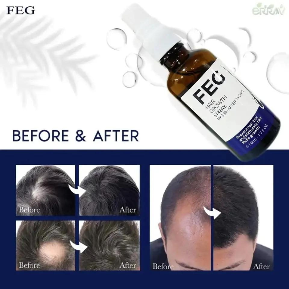FEG-Huile de Soins Capillaires Biologique, pour Cheveux Longs, pour la Maison, Rotterdam y, 50ml