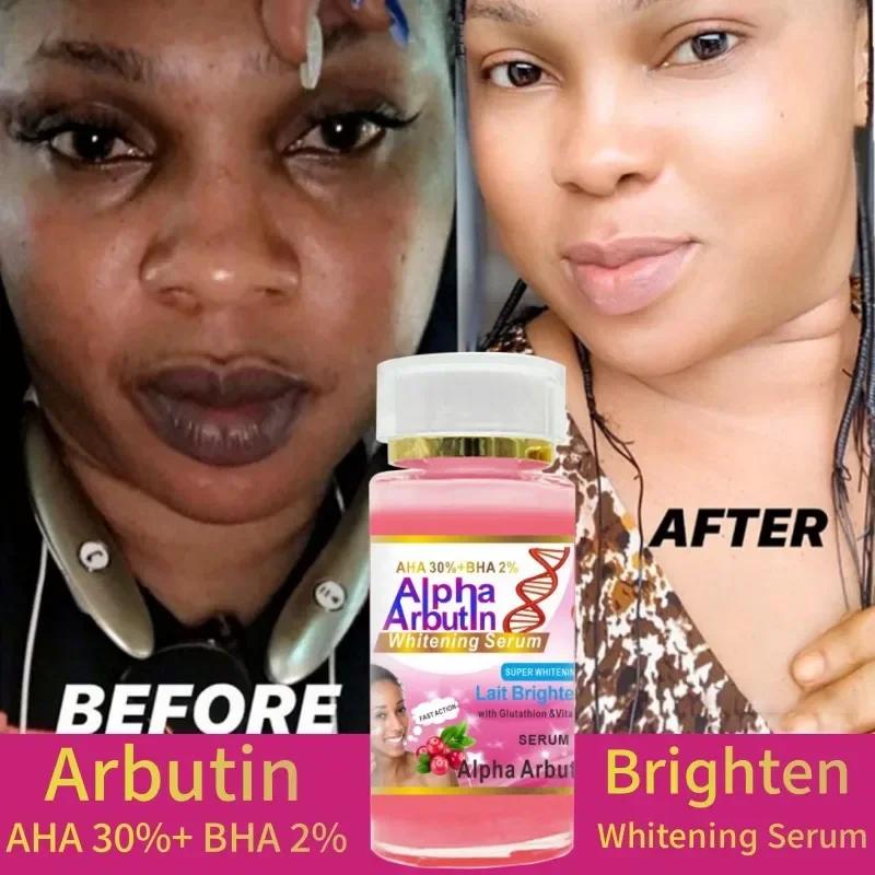 120 ml SUPER AHA 30% + BHA2% Alpha Arbutin X 3 sérum visage éclaircissant au lait avec la glutathion