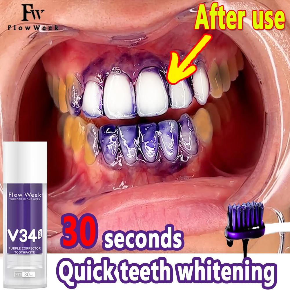 Flow-du-- Dentifrice orthodontique V34 Pro, Protection des dents, Soin de l'émail dentaire, Décontam