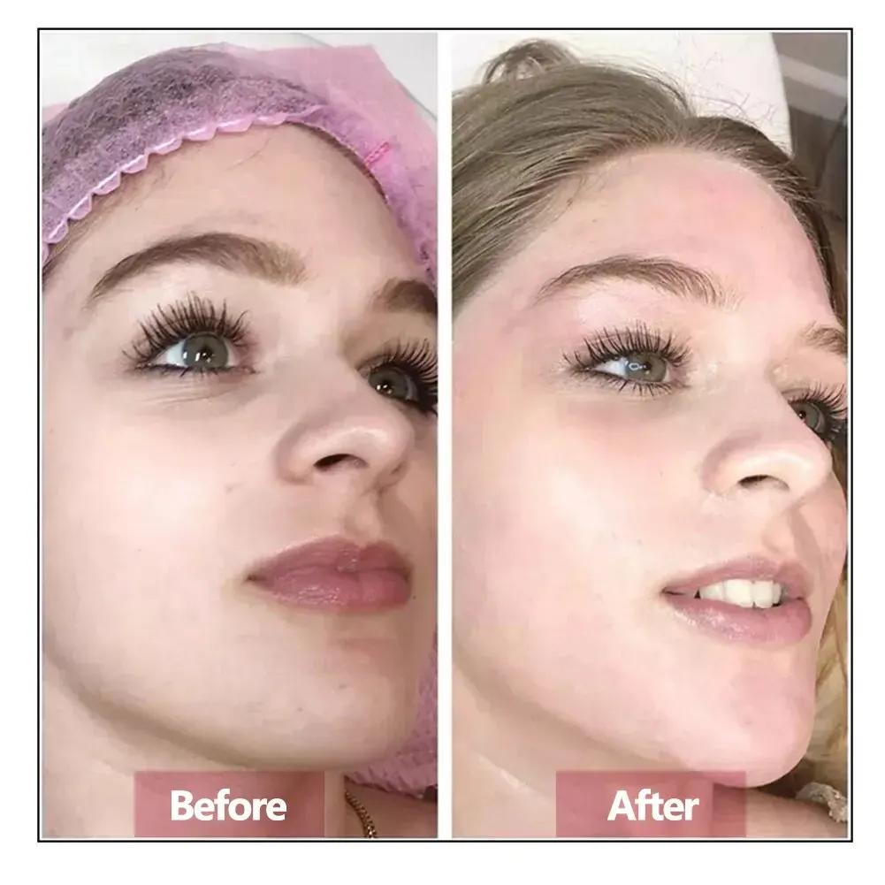Sérum pour le visage à l'acide hyaluronique