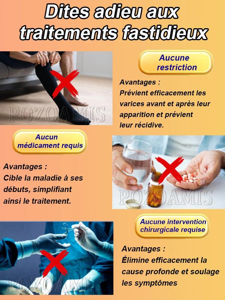 Promouvoir la circulation sanguine dans les varices