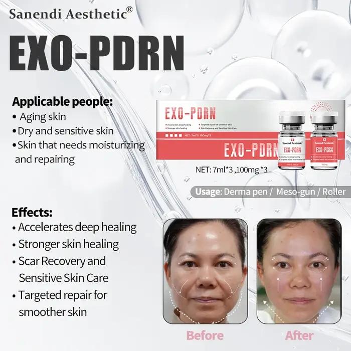 Sérum Anti-âge pour exosomes PDRN, élimine les ridules, les cicatrices d'acné, Anti-inflammatoire, s