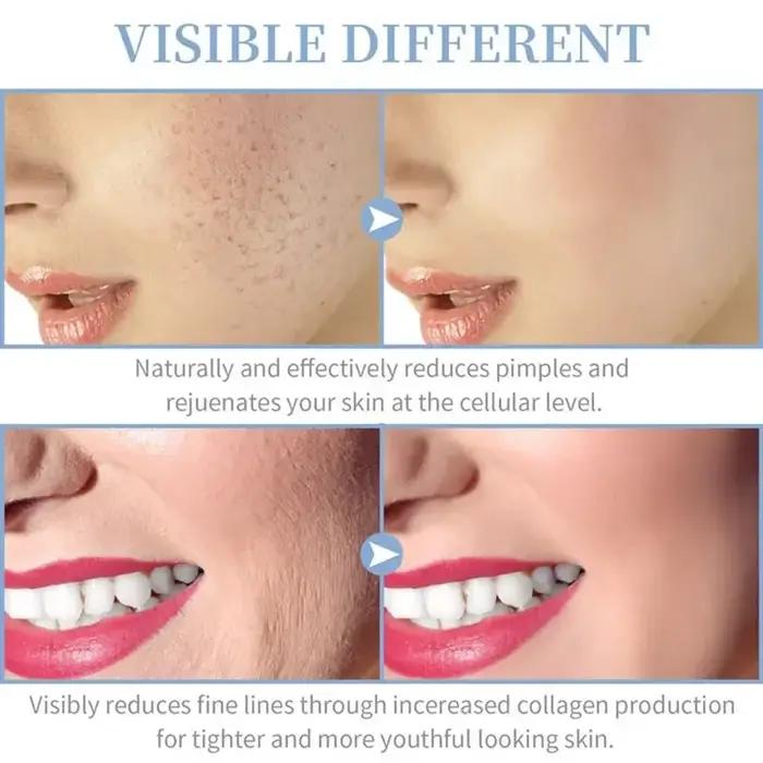 4 en 1 électrique portatif pour le visage outils de beauté de la peau Portable haute fréquence bague