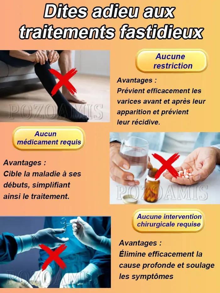 Promouvoir la circulation sanguine dans les varices