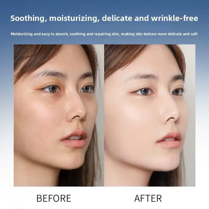 Sérum à l'acide hyaluronique anti-âge hydratant rétrécissant les pores essence blanchissante pour soins de la peau et instruments à micro-aiguilles occasions spéciales
