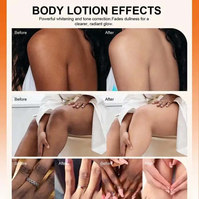 Lotion éclaircissante à l'arbutine LKIAE pour le visage et le corps, réduit les taches, nourrissante