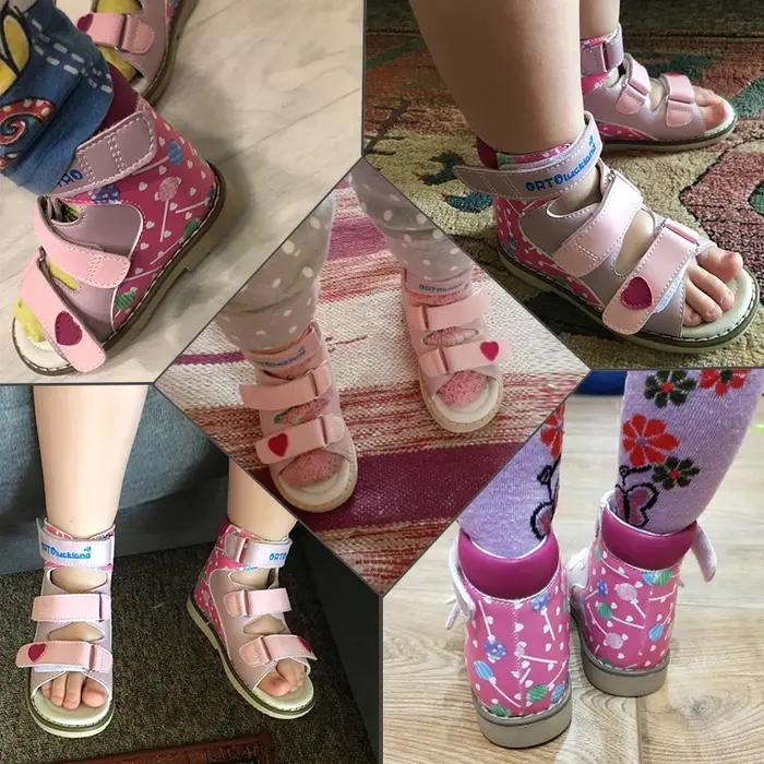 Informations sur Uckland-Sandales d'été pour filles, chaussures Orth4WD pour enfants, style coréen,