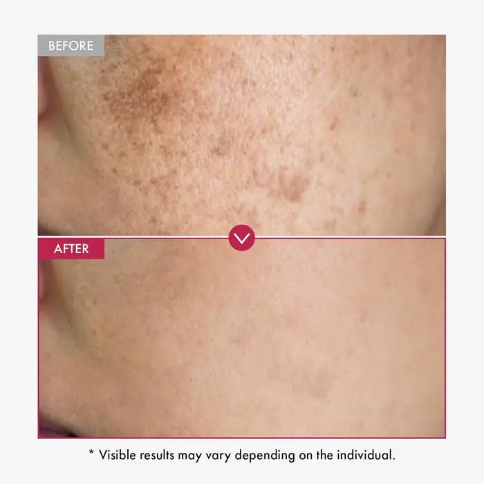Sérum visage blanchissant pour la peau, 500ml, réduit les taches, hydratant, même le teint, avec Alp