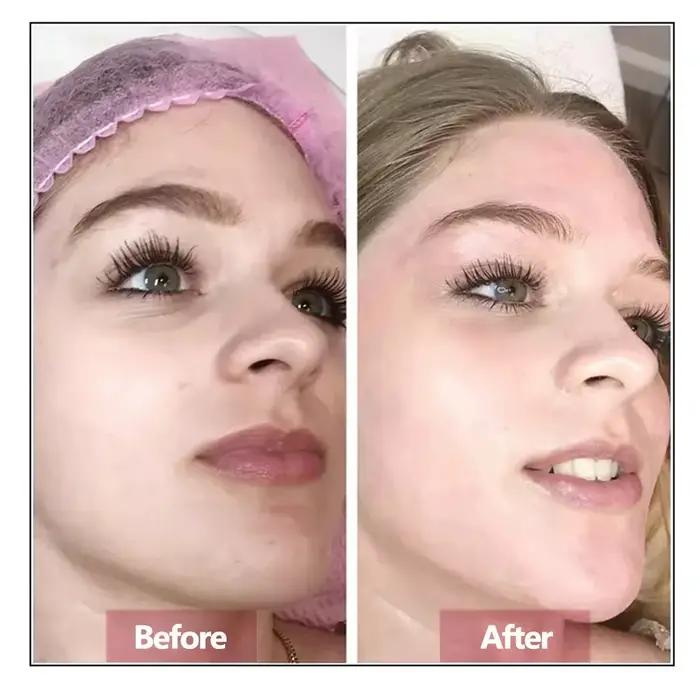 Sérum pour le visage à l'acide hyaluronique