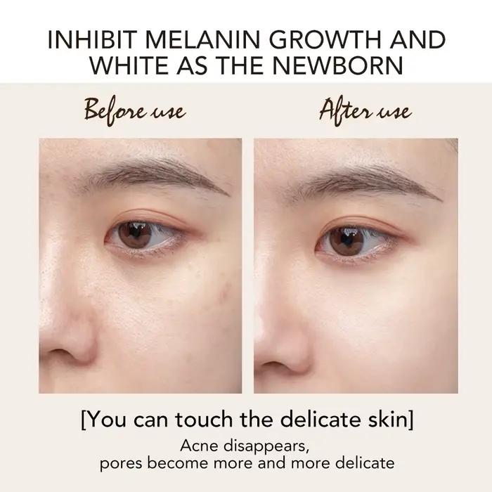 AILKE Lotion visage blanchissante à l'acide kojique, hydratante, éclaircissante, même le teint, adap